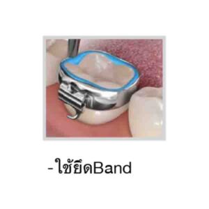 Band Cement